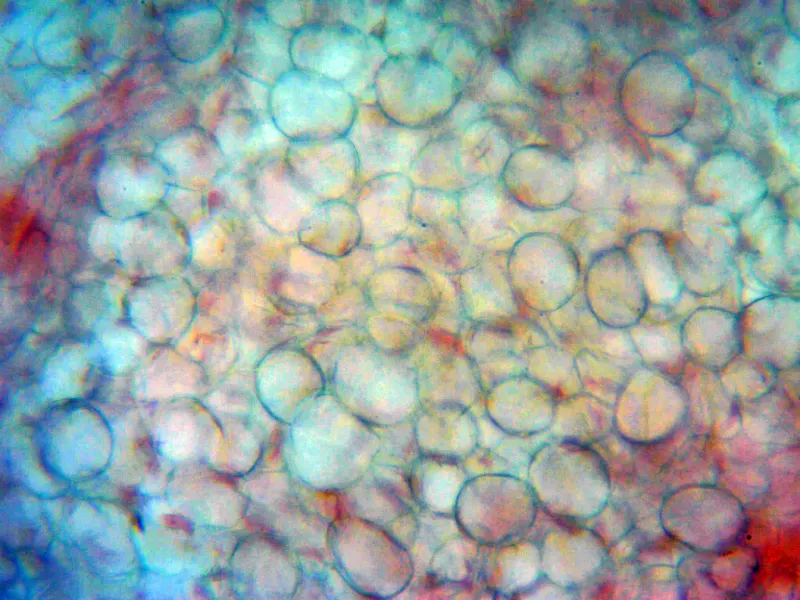 Clathrus crispus 10 - X 400 1